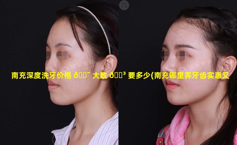 南充深度洗牙价格 🐯 大致 🌳 要多少(南充哪里弄牙齿实惠又技术好)